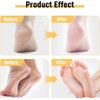 Anti-Cracking Cream, For Dry Cracked Feet And Hands, Prevent From