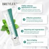 Breylee | Crema Elimina Estrías, Cicatrices, Acné Y Manchas