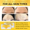 24K Gold Forehead Wrinkle Patches, with Aloe, Collagen, Vitamin E