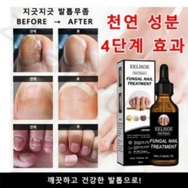 Thick Toenail Fungus Repair Essence 50ml 3ea