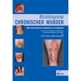 Blickdiagnose chronischer Wunden: Über die klinische Inspektion zur Diagnose