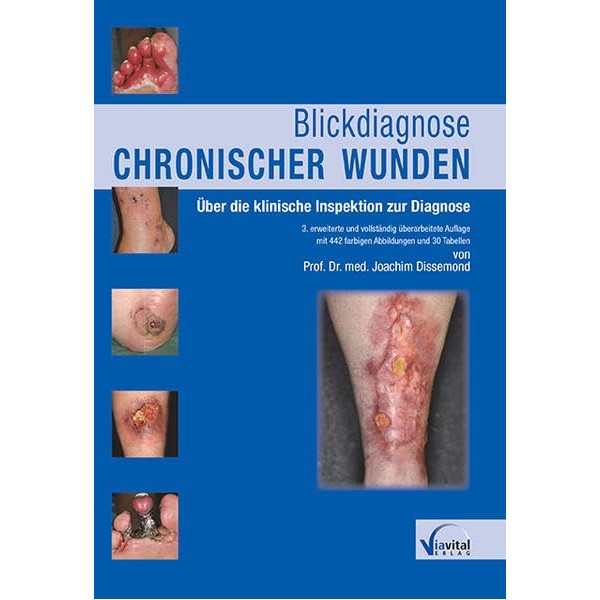 Blickdiagnose chronischer Wunden: Über die klinische Inspektion zur Diagnose