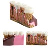 Dental Caries Tooth Anatomy Model Tooth Pathology Models Caries Evolution