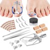 Ingrown Toenail Treatment Kit Glue Free Pedicure Ingrown Toenail Corrective