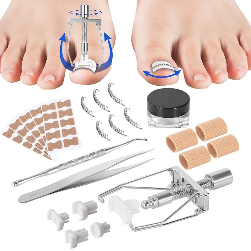 Ingrown Toenail Treatment Kit Glue Free Pedicure Ingrown Toenail Corrective