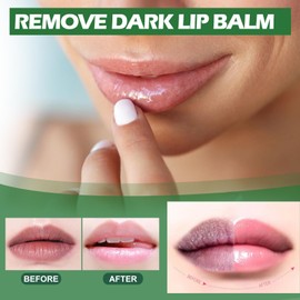 Lip Lightening For Dark Lips, Lip Balm Lips Pink Bleaching Cream Balm,Moisturizing Lip Balm Whitening & Brightening, Remove Dark Lips 3G (A)