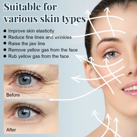 Protein Thread Lifting 5 Piezas Protein Thread Lifting Set Absorbible Soluble Profundamente Hidratar Arrugas Quitar Cuidado de la Piel Hilo de Proteína, Set Rostro