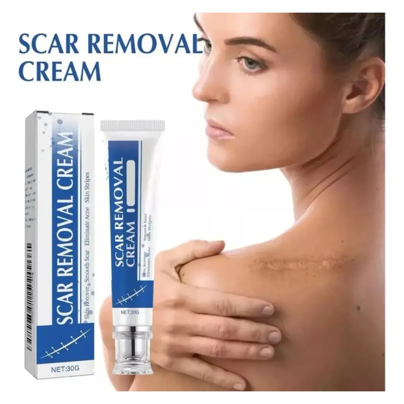 Generic - 1fb Crema De Silicona Para Eliminar Cicatrices Quirúrgic