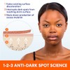 Palmer’s Skin Success Crema Aclarante con Vitamina E y Niacinamida