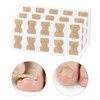 Big Toe Ingrown Toenail Correction Tape (10pcs) - Prevents Curvature DD-11991 6ea