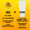 Sensitive Skin Balm - Uber Balm | Eczema & Psoriasis