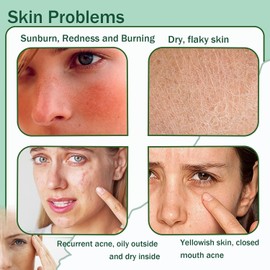8 Piezas De Gel De Aloe Vera Puro - Gel Hidratante De Aloe Vera Para Rostro Y Piel, Gel De Aloe Vera Hidratante No Pegajoso