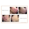 DCI SOLUCION ANTIACNE