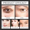 Eye Cream for Dark Circles and Puffy Eyes,Anti-Wrinkle under Eye