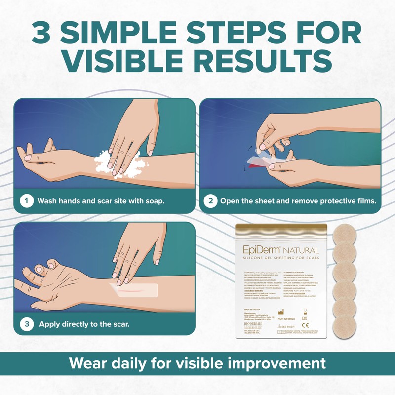 Epiderm Silicone Scar Circles – Medical Grade Silicone Scar Patches