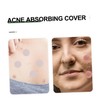 Baluue Hydrocolloid Patch 144 Sheets Daily Skin Treatment Pad Breathable