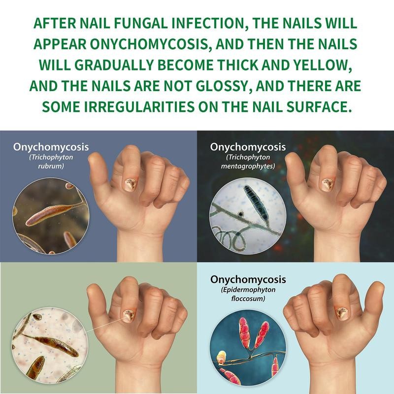 JAYSUING Ginger Nail Care Liquid, Nail Nutrients, Repairs Damaged and