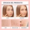Parches Para Acne Granos Hidrocoagulante Para Espinillas Pim