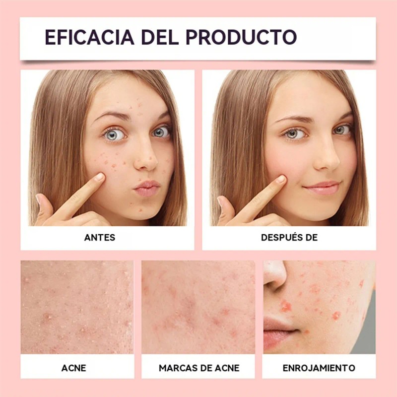 Parches Para Acne Granos Hidrocoagulante Para Espinillas Pim