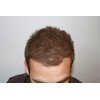 Mane Hair Thickener Direct from the Manufacturer for hair loss