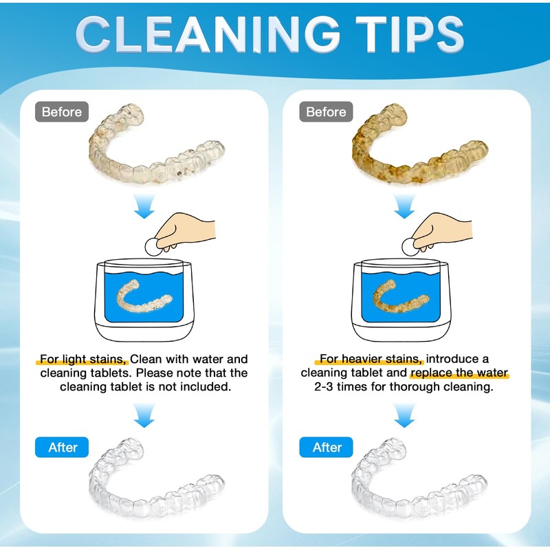 Exluvon Ultrasonic Retainer Cleaner 45kHz, 250ML Portable Ultrasonic Cleaner, Professional