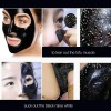 Mascarillas Facial Peel Off Carbón Activado Puntos 100pzs
