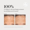 Naturium BHA Liquid Exfoliant 2%, with Salicylic Acid & Bioactive