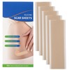 Silicone Scar Sheets 1.6" x 6" Silicone Scar Tape for