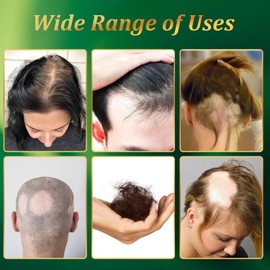 Lidoria Ginger Anti Hair Loss 7 Days,Lidoria Ginger Anti Hair Loss,Ginger Oil for Hair Growth,Ginger Essential Oil Repair Damaged Hair for Stronger Thicker Longer Hair (2PCS)