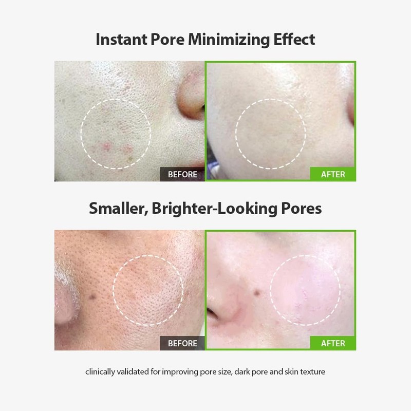 Sungboon Editor Ampolleta Green Tomato Pore Lifting Ampoule de 30ml