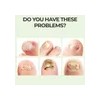 2pcs 7 Days Nail Repair, Nail Serum & Cuticle Care