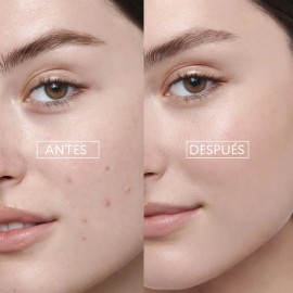 Limpiadora Facial Gel Skin First Bye Granitos Cyzone