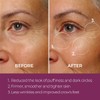 Blinc Eye Repair Peptide Complex 15g