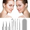 8 Stück Mitesserentferner Komedonenquetscher, Pickel Werkzeug Set, Edelstahl Mitesserentferner, Akne