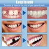 100g Temporary Tooth Filling, 1PC Plastic Tweezers, Thermal Bonded Tooth