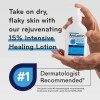 AmLactin Intensive Healing Body Lotion 15% Lactic Acid Moisturizer 7.9