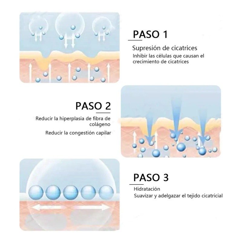 2 cajas Parche de silicona para cicatrices, adecuado para cicatrices