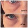 Instant Eye Bag Puffiness And Wrinkle Remover Cream For Women