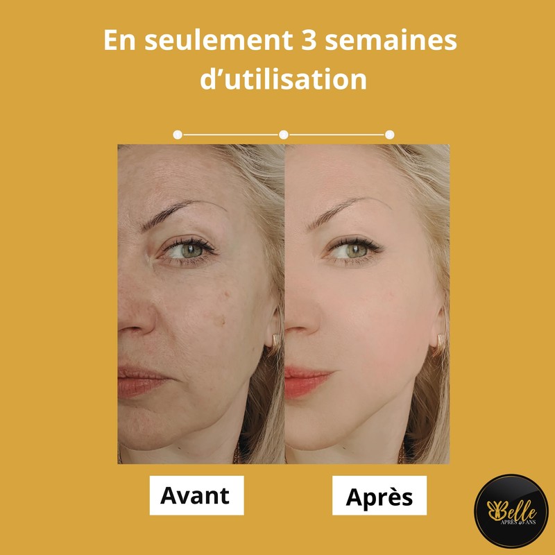 Vitamin C Serum – gegen braune Flecken – gleicht und