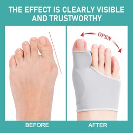 Tpubmity 2 Pairs Bunion Corrector,Hallux Valgus Socks,Hallux Valgus Cushion Toe Brace,Reduces Pressure,Big Toes Separator & Straightener for Comfort and Support,Men & Women,Black