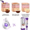Iu Crema Epiglow Melanex Antihiperpigmentante Avanzada,