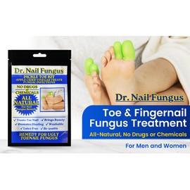Nail Fungus: Toenail Fungus, Remedy for Ugly Toes, Natural Remedy, Apple Cider Solution for Nail Fungas, Dr. Nail Fungus