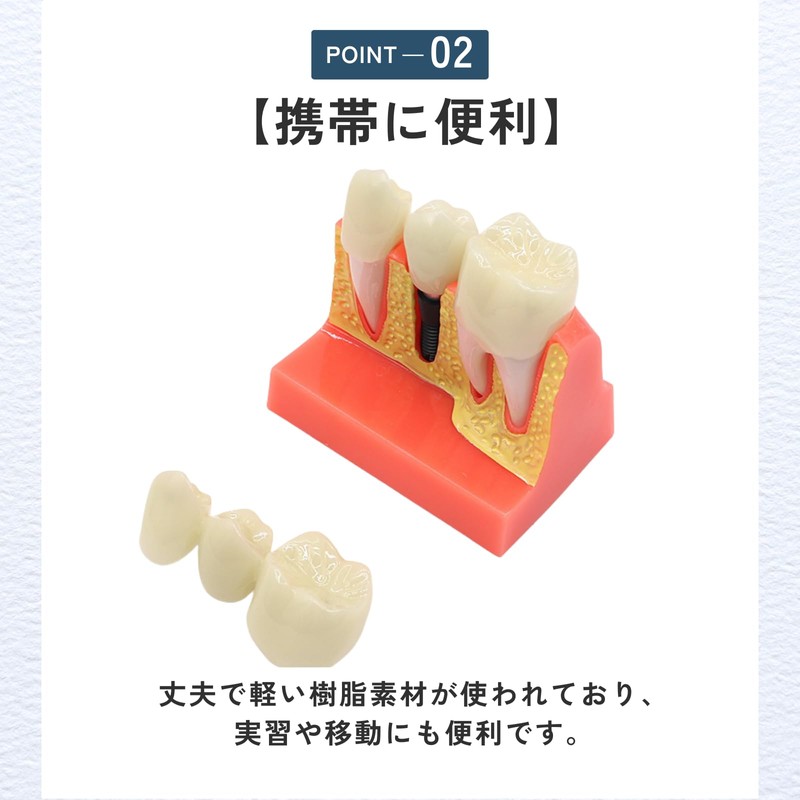 ideamall Implant Model Teeth Course Practice Model Educational Compact
