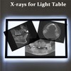 8 Dental X-Rays