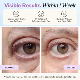 LilyAna Naturals Eye Cream for Dark Circles and Puffiness, Anti Aging Under Eye Cream for Wrinkles and Bags helps Improve Dryness; for Sensitive Skin (Bottle, 1.0 Ounce (Pack of 1))