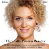 Suero Antiarrugas Coreano Bakuchiol Retinol Y 10 Vitaminas