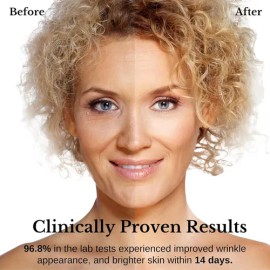 Suero Antiarrugas Coreano Bakuchiol Retinol Y 10 Vitaminas                                                                                            