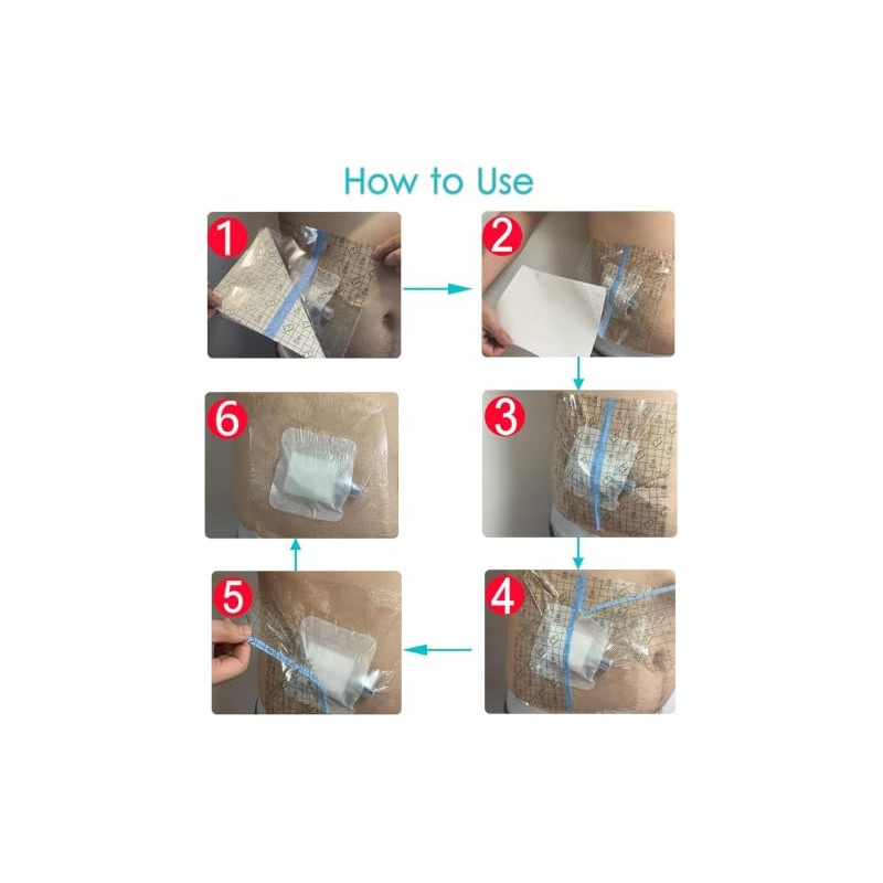 50 Pack Waterproof Shower Bandages for Port Surgery Incision Aftercare