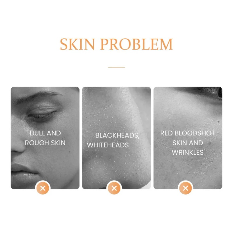 Mascarilla Facial Vc En Barra, Película De Barro Para Limpie