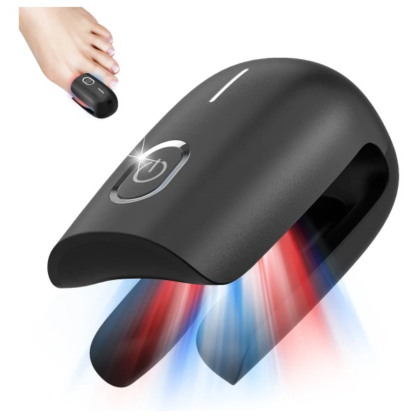 Nuevo Dispositivo Láser Antihongos En Las Uñas De Los Pies